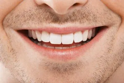 closeup of a man's transformed smile after a smile makeover at Sandia View Family Dental